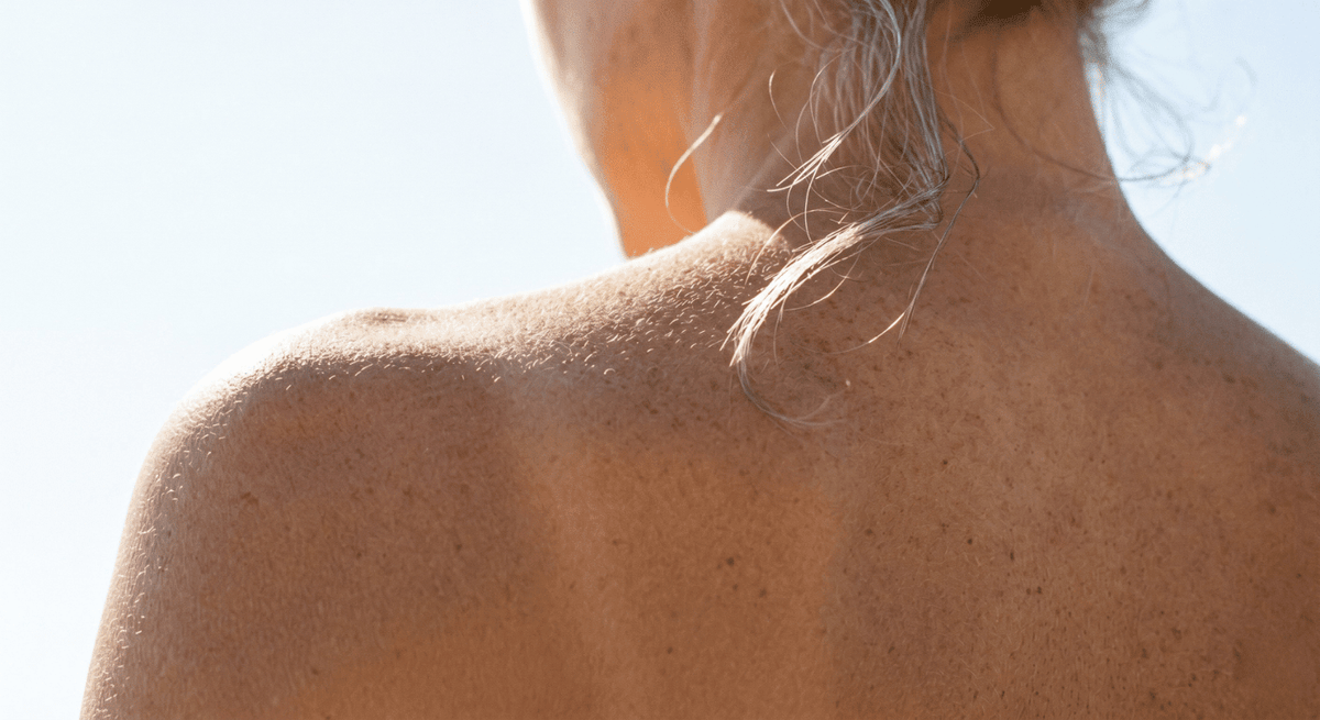 Why Women Lose Collagen Faster Than Men, and What You Can Do About It