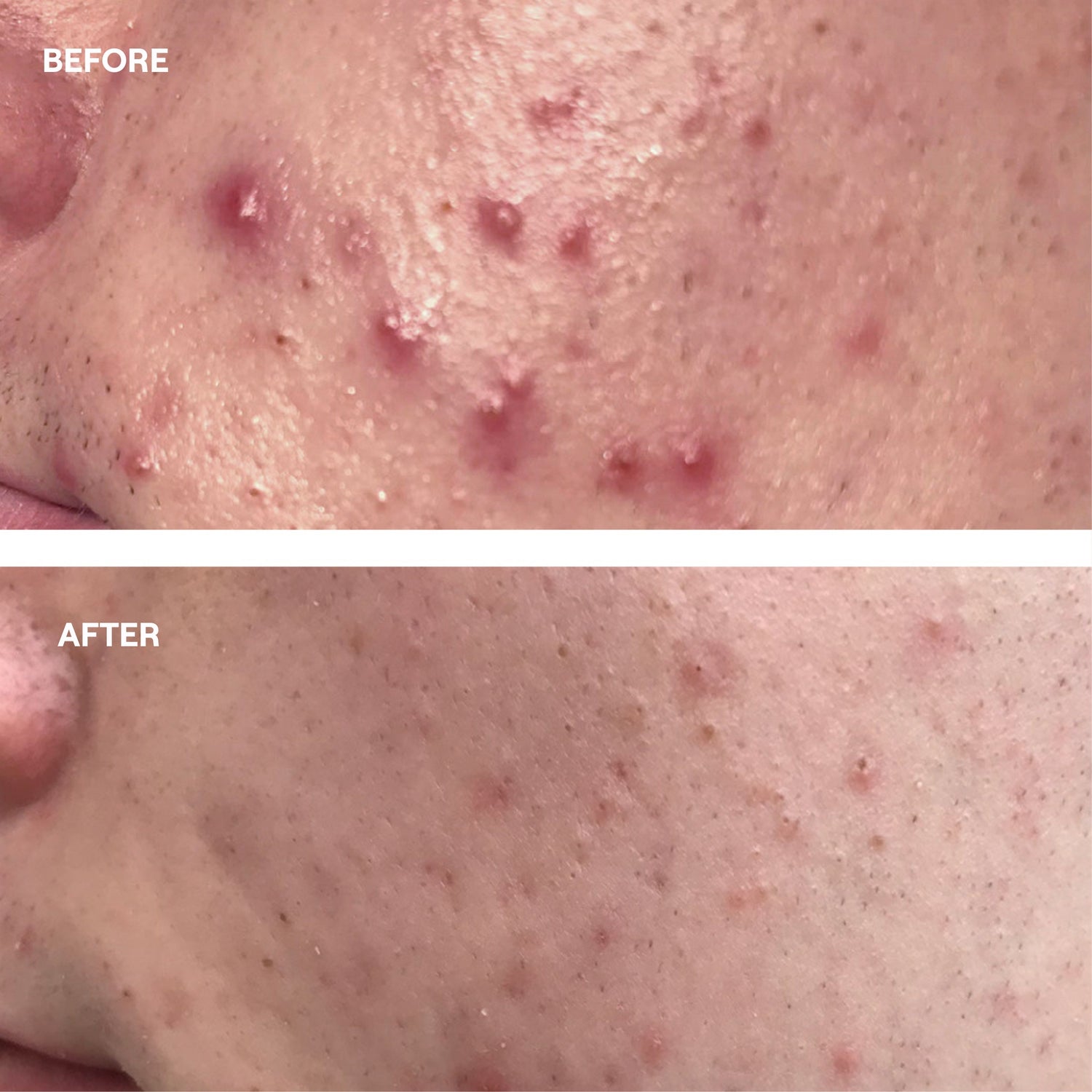 Probiotic Skin Oil