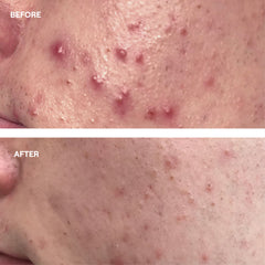 Probiotic Skin Oil