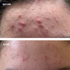 Probiotic Skin Oil